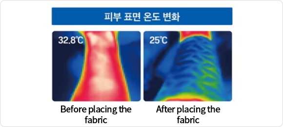 피부 표면 온도 변화