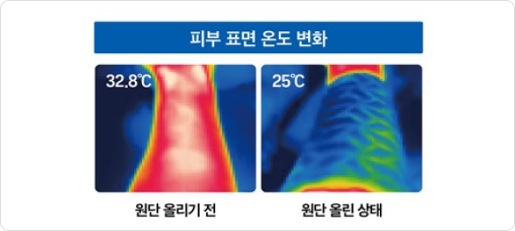 피부 표면 온도 변화